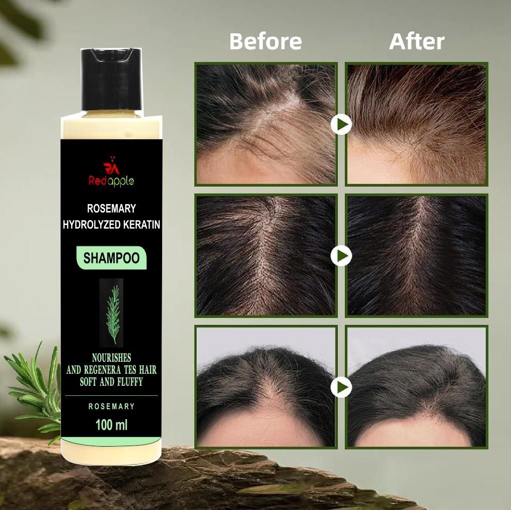 Rosemary Hydrolyzed Keratin Shampoo – Natural Hair Repair & Strengthening Formula (100 ml)